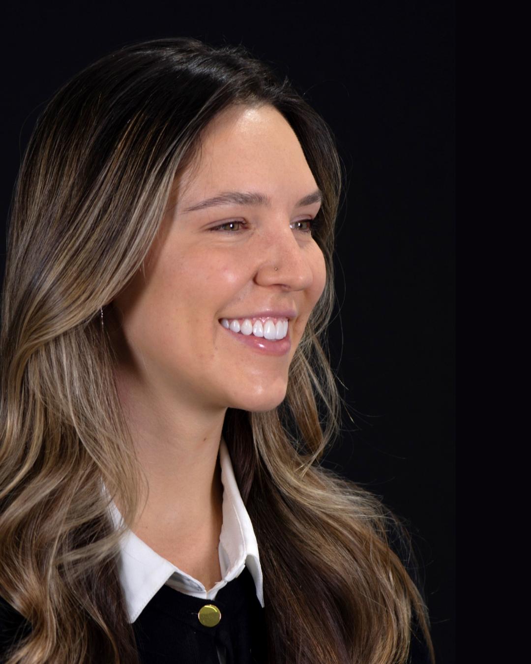 After — Left Profile