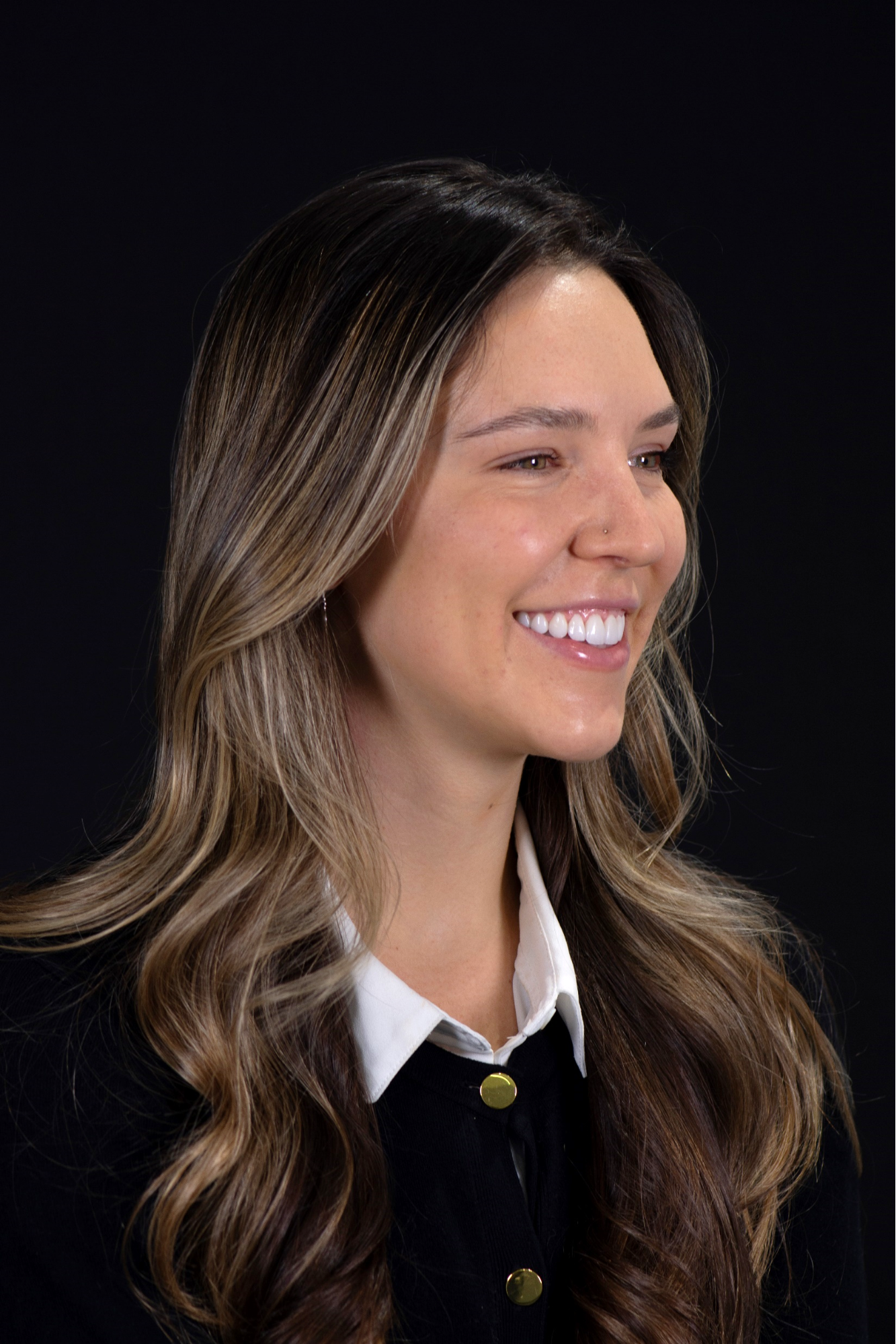 After — Left Profile