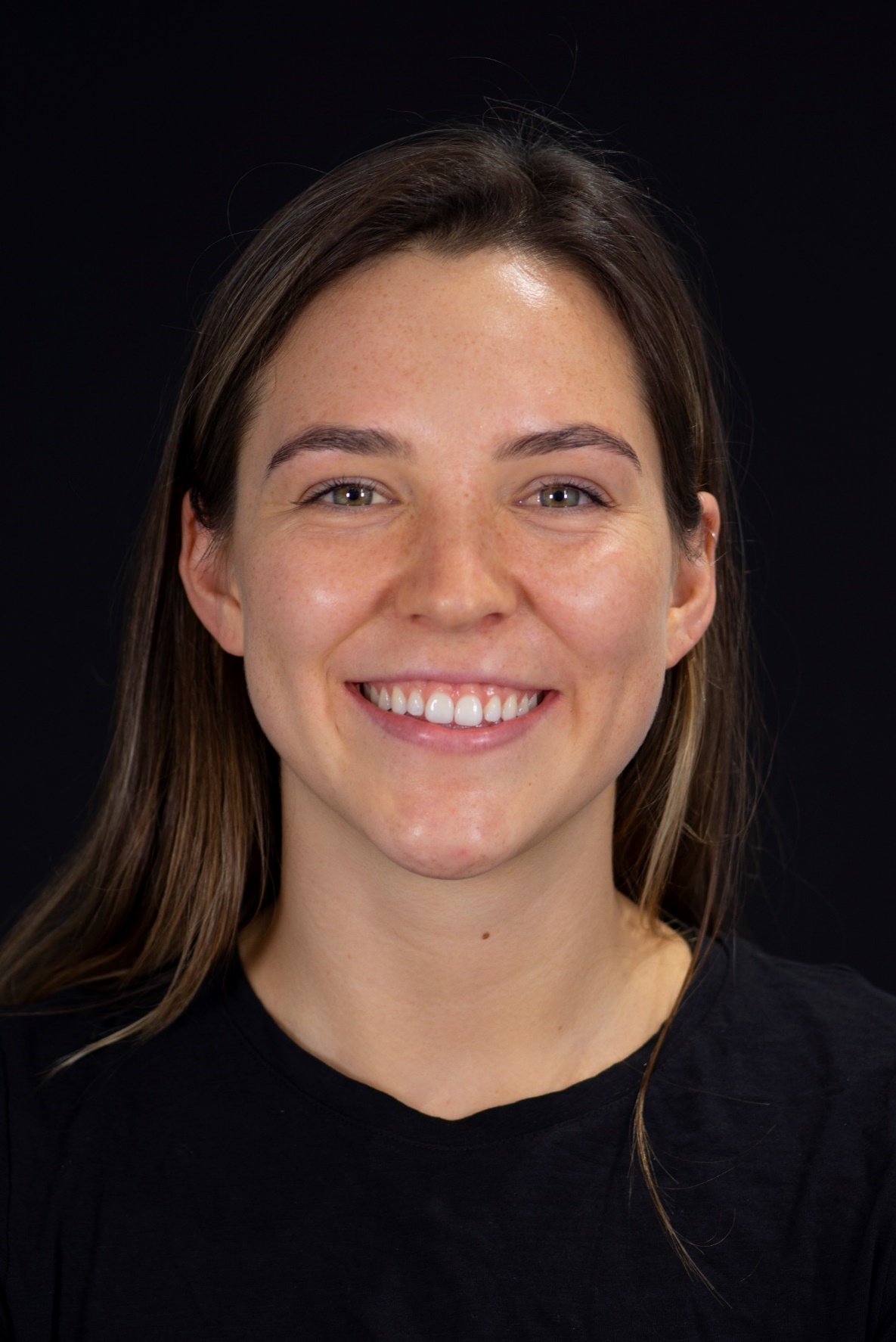 Before — Front View