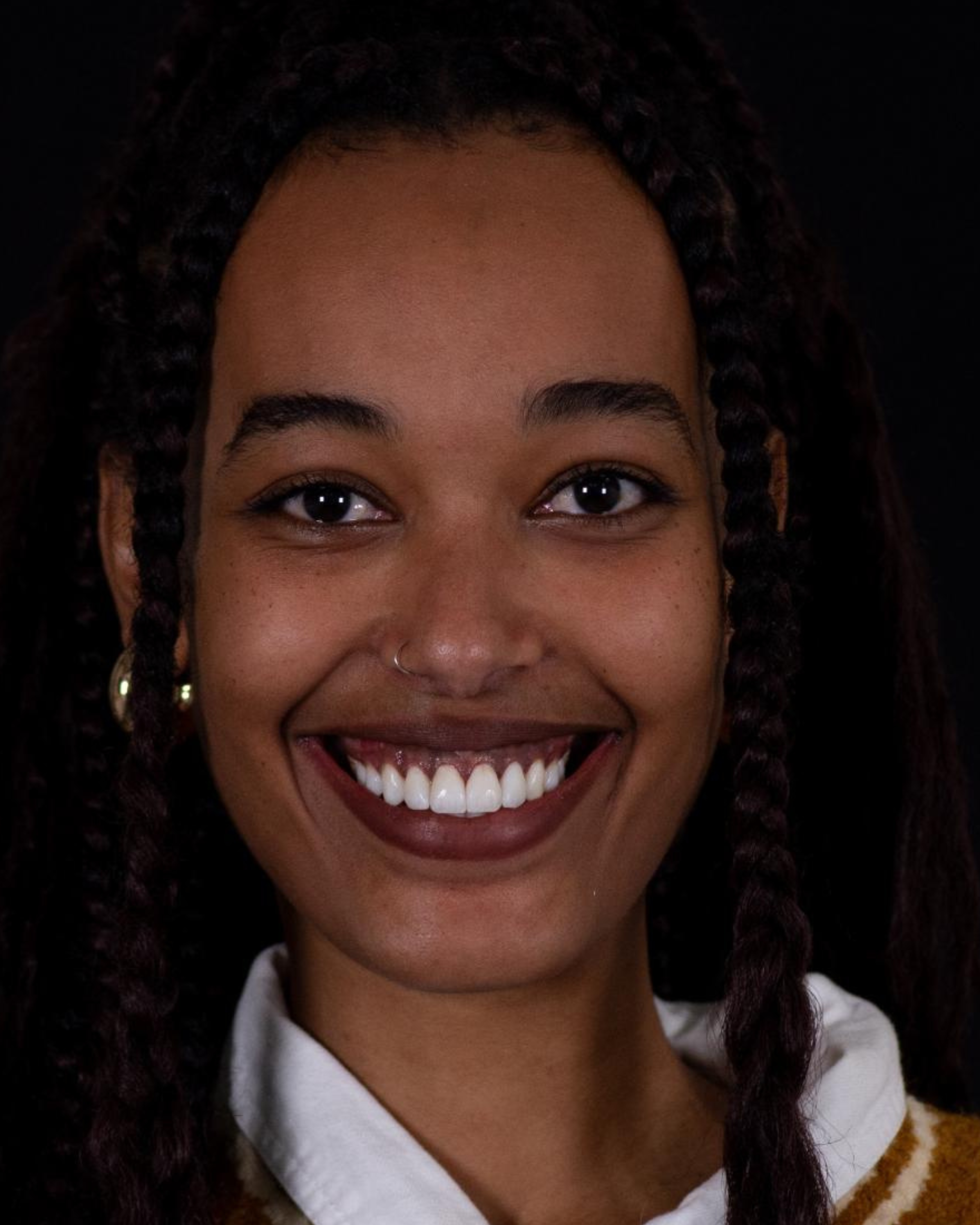 After — Front View