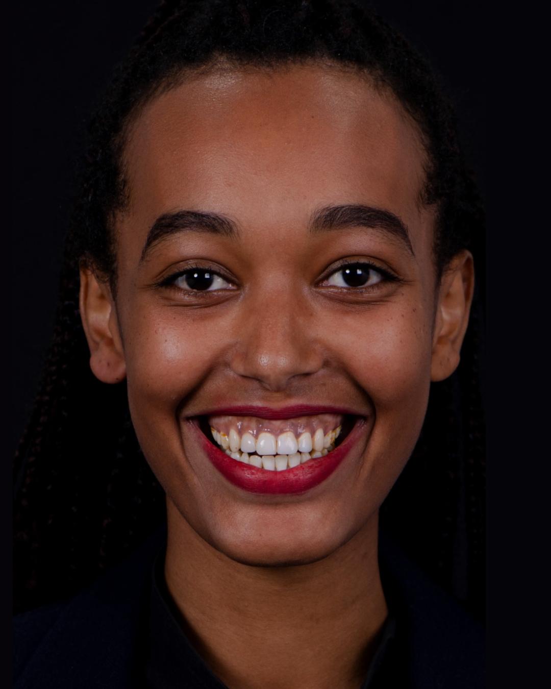 Before — Front View