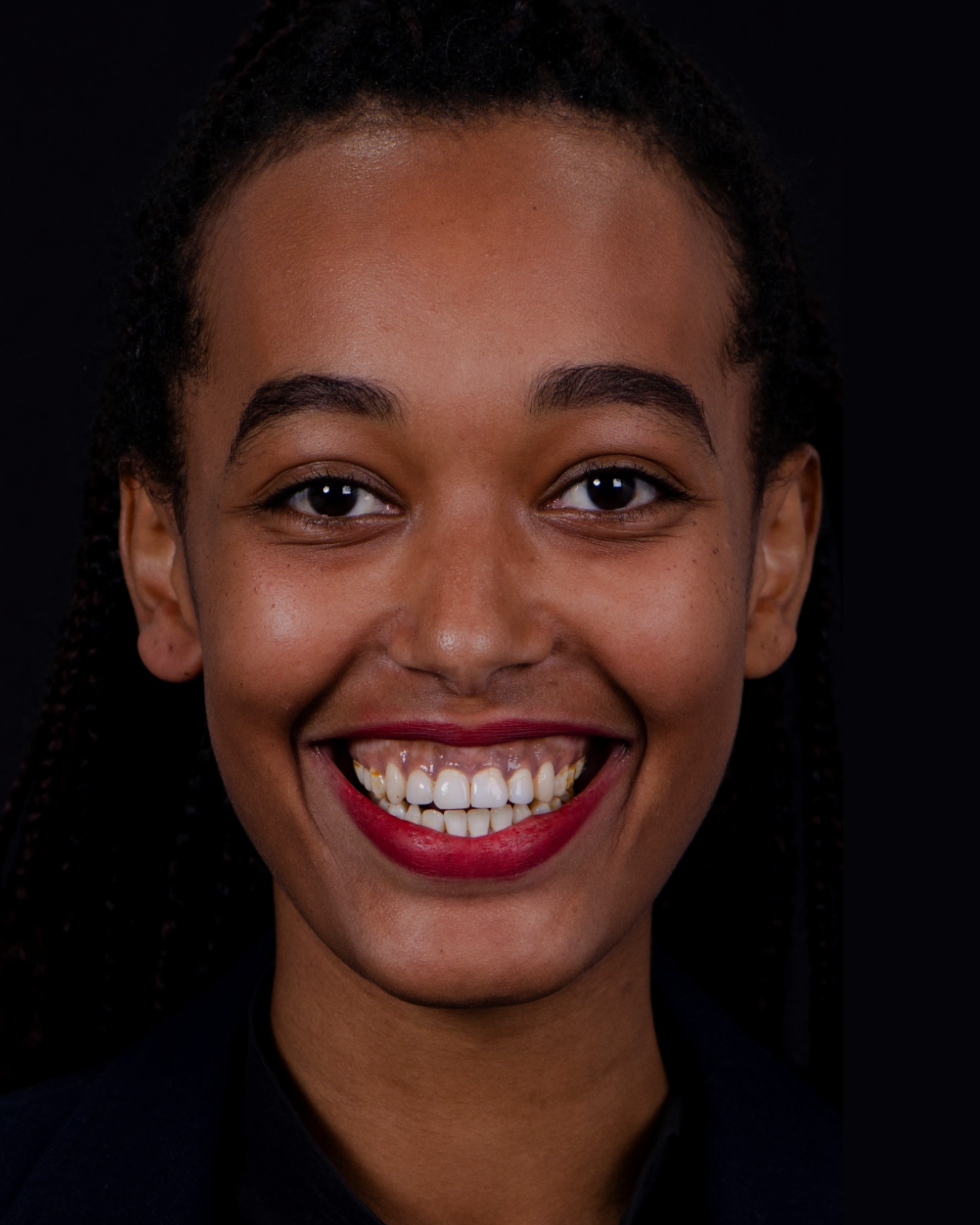 Before — Front View