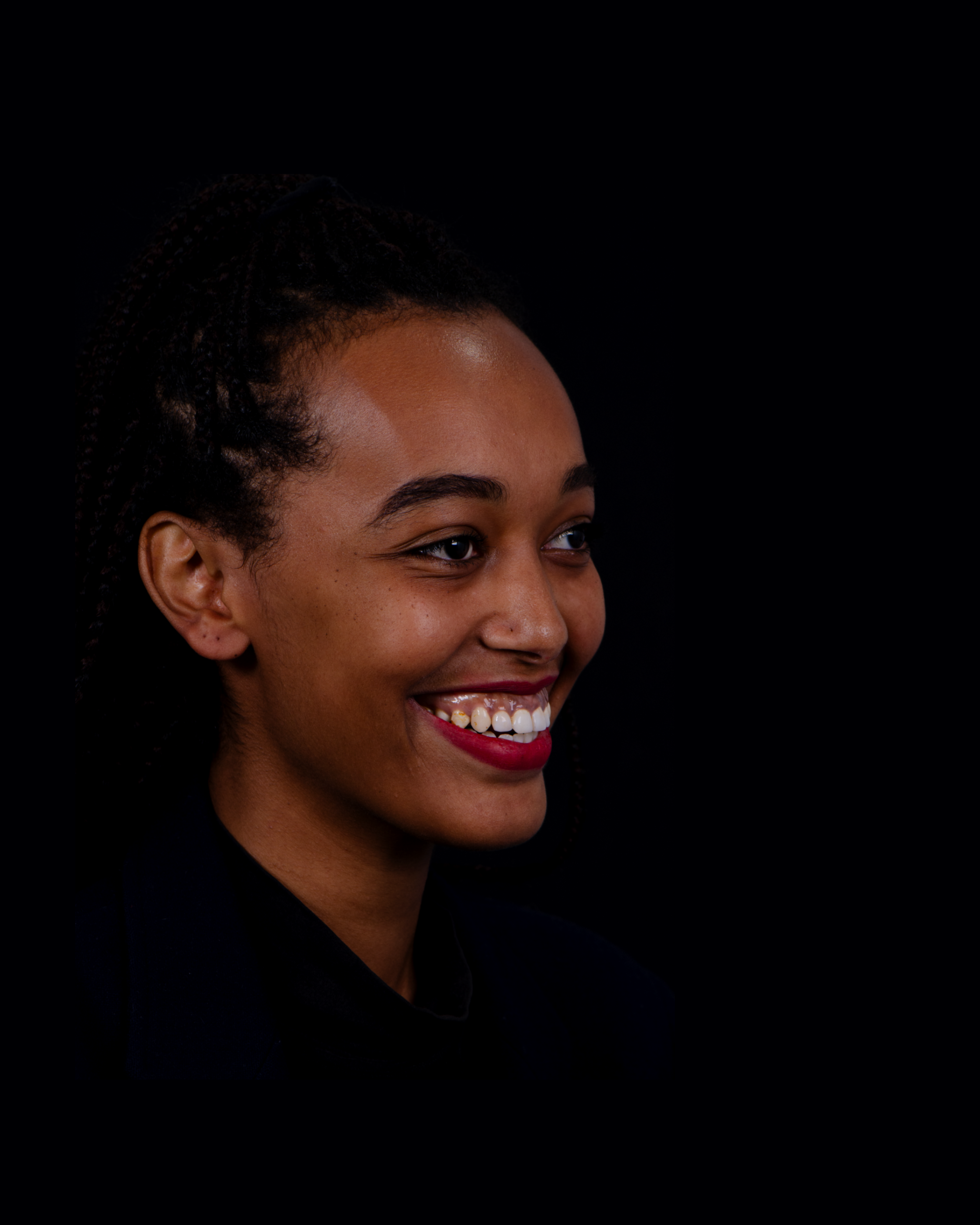 Before — Left Profile