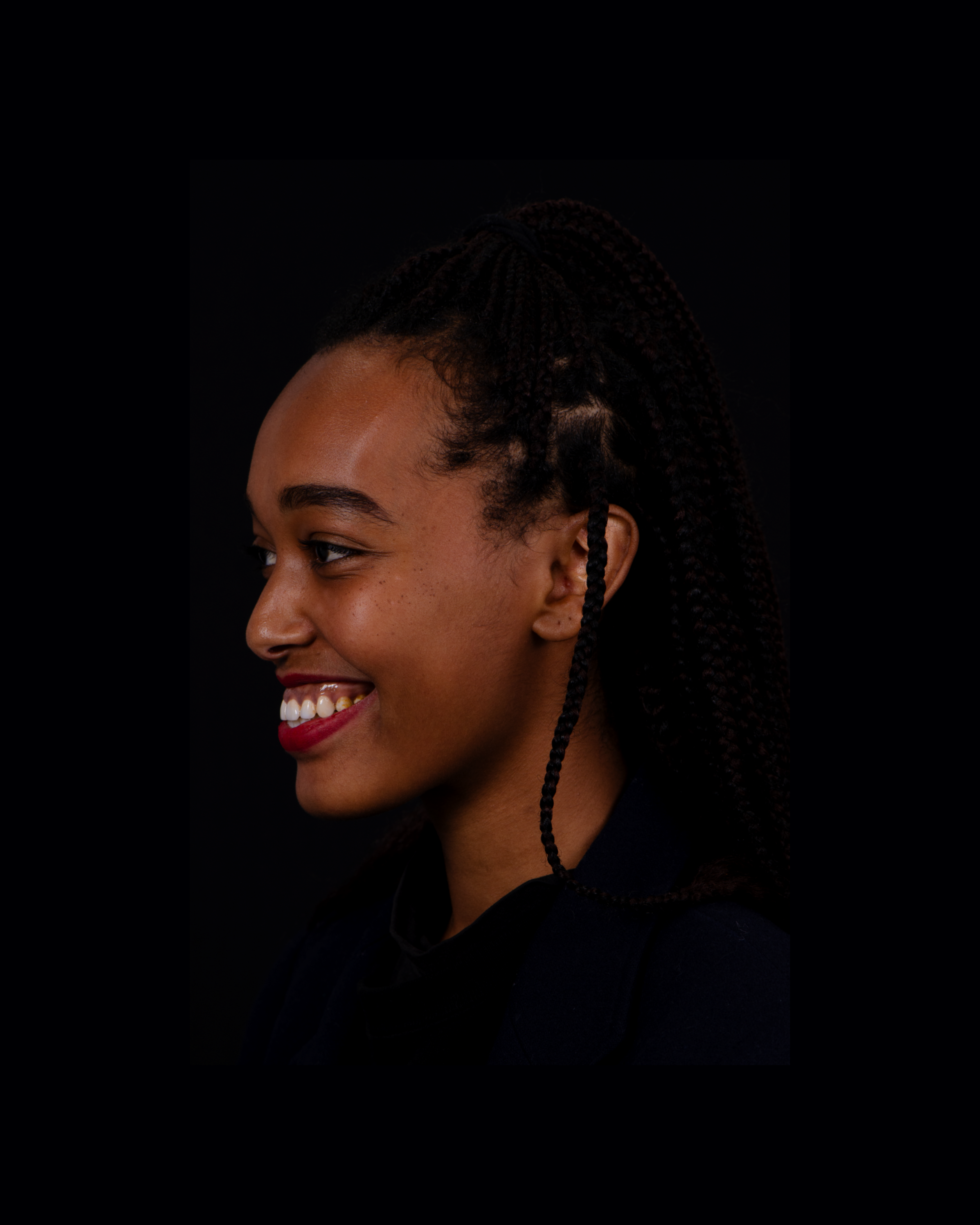 Before — Right Profile