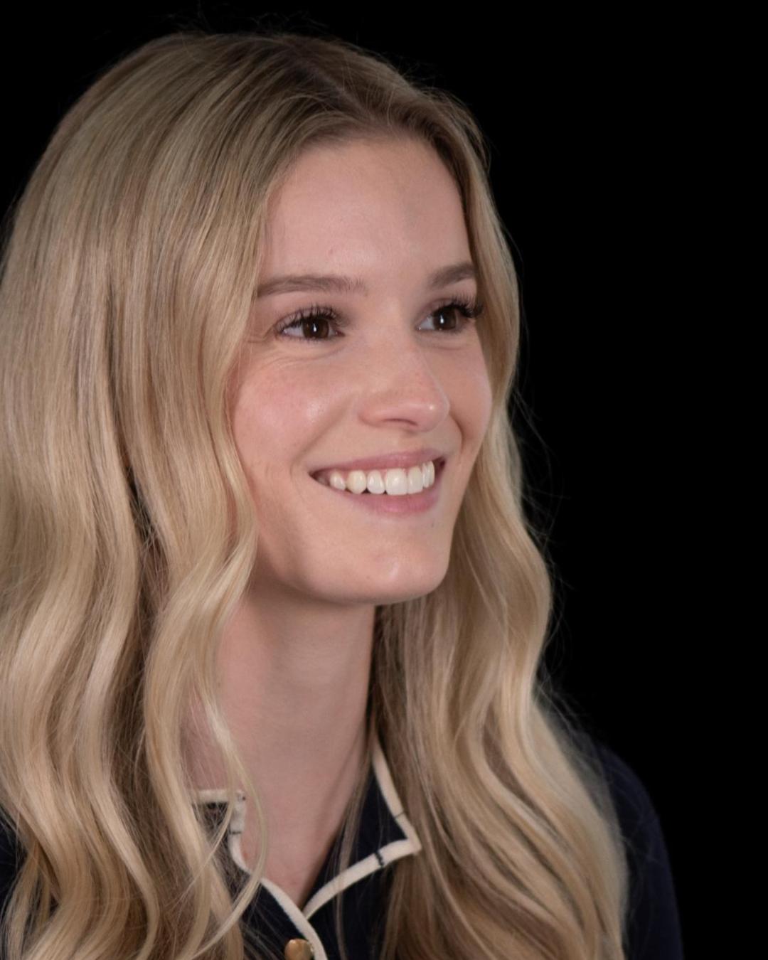 After — Left Profile