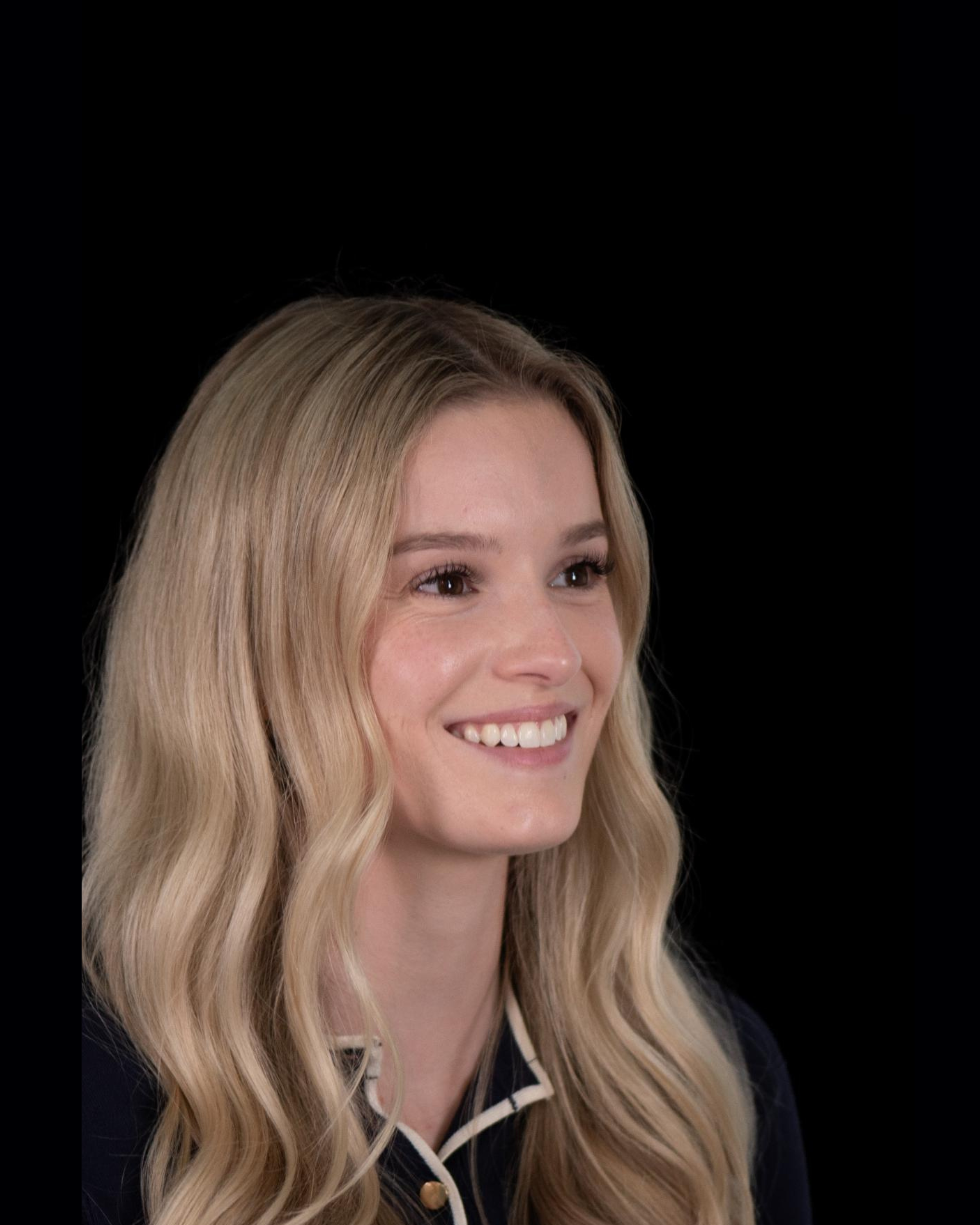 After — Left Profile