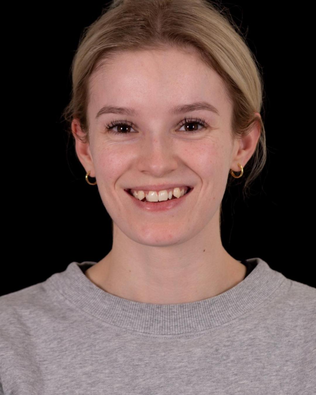 Before — Front View