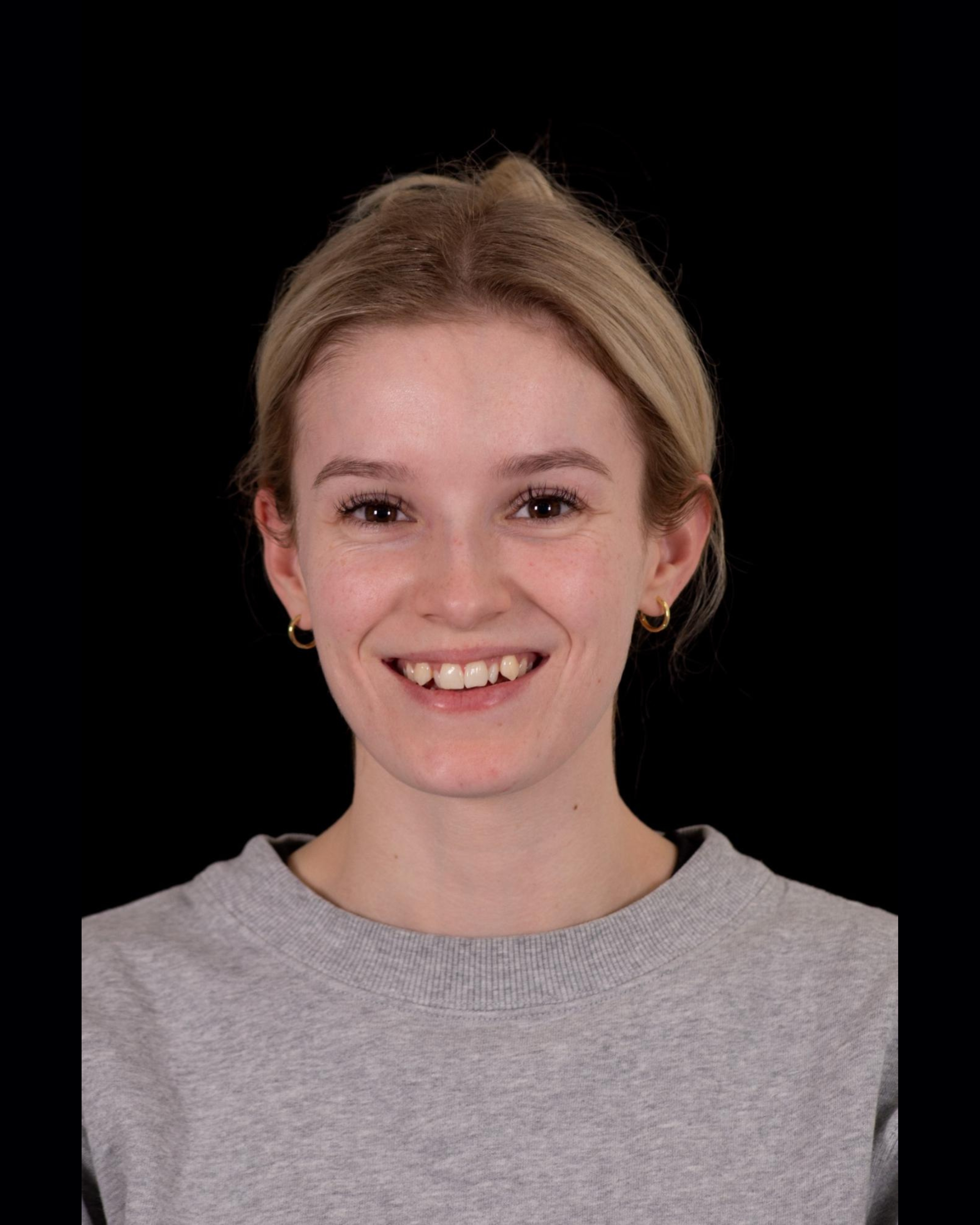 Before — Front View