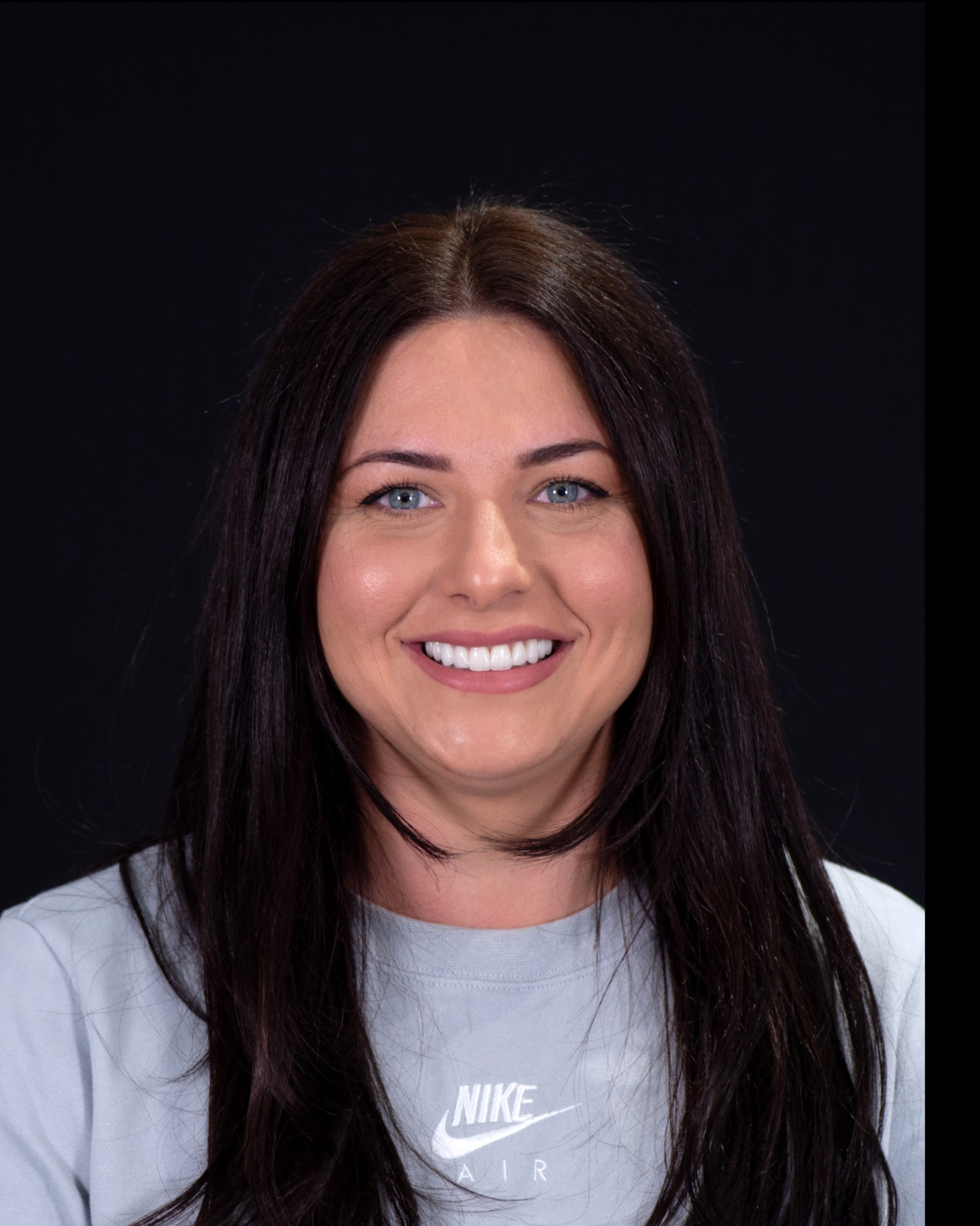 After — Front View