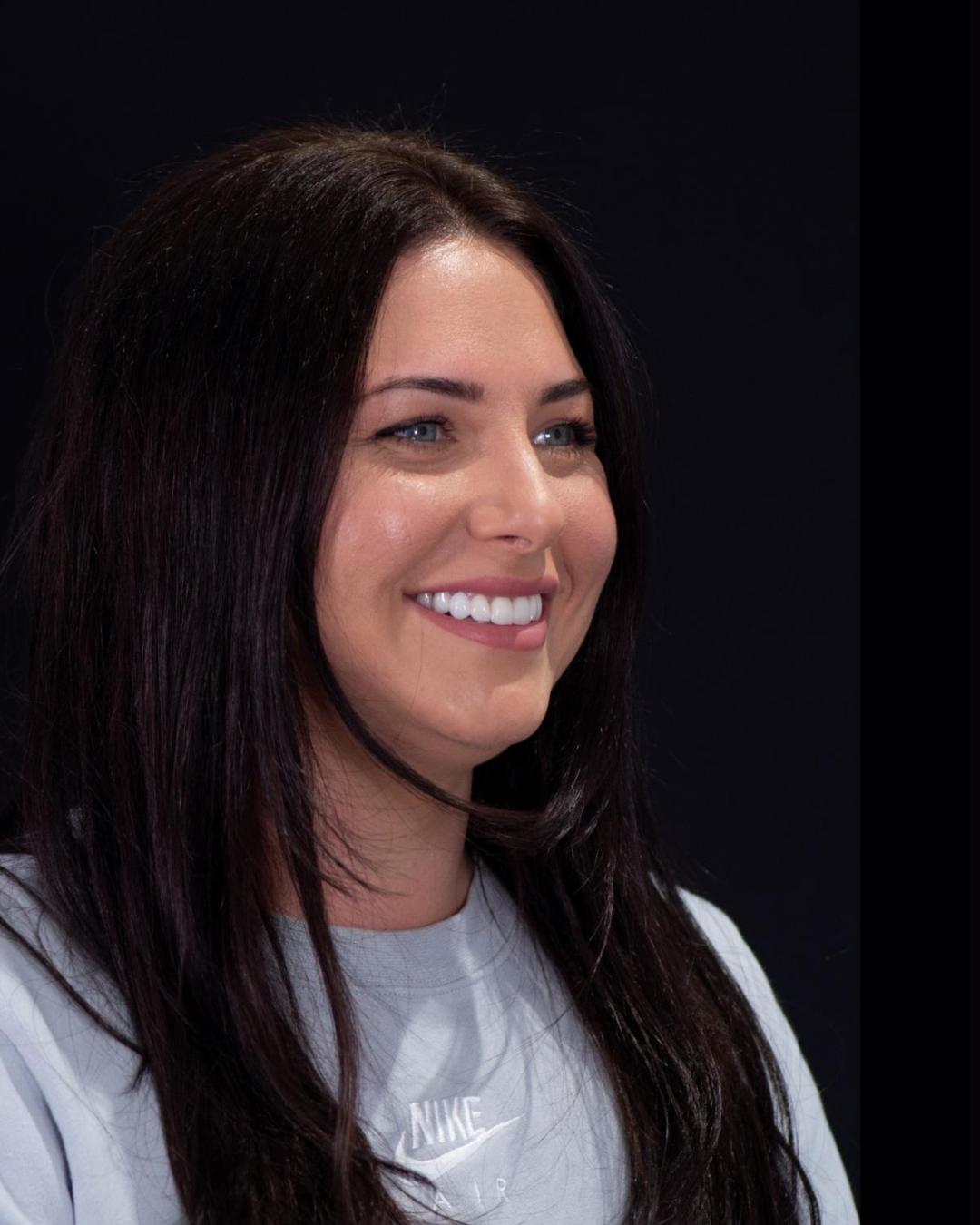 After — Left Profile