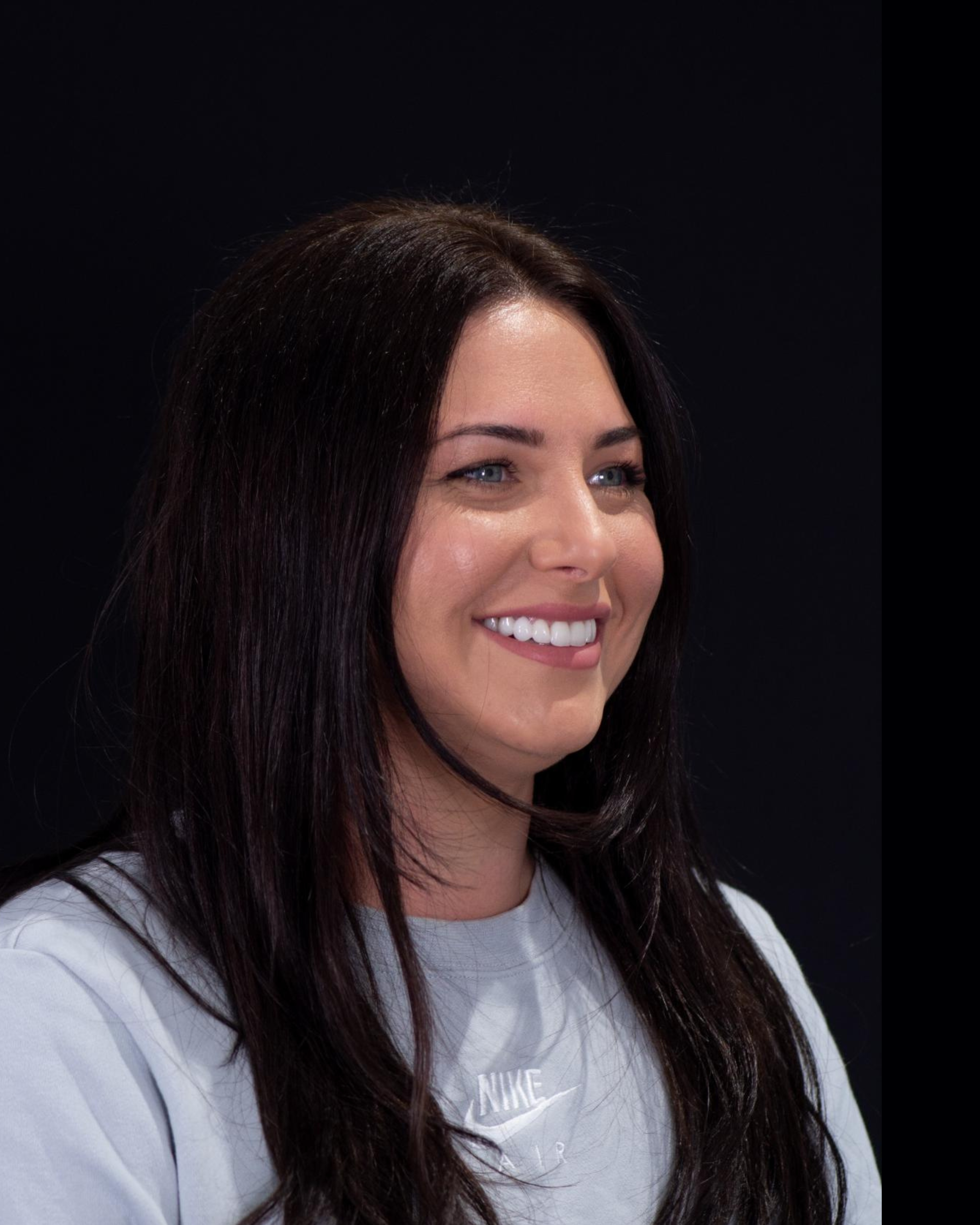 After — Left Profile