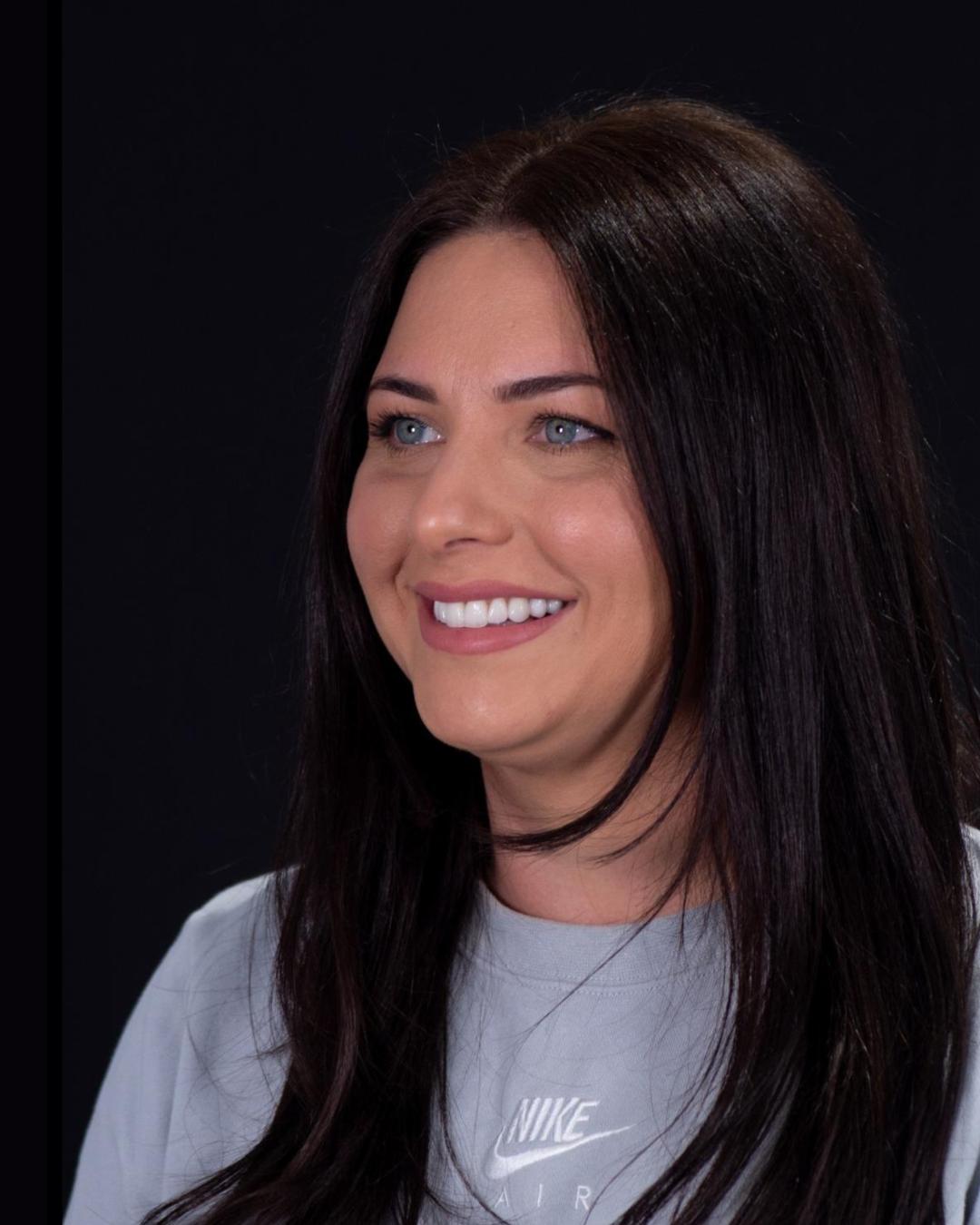 After — Right Profile