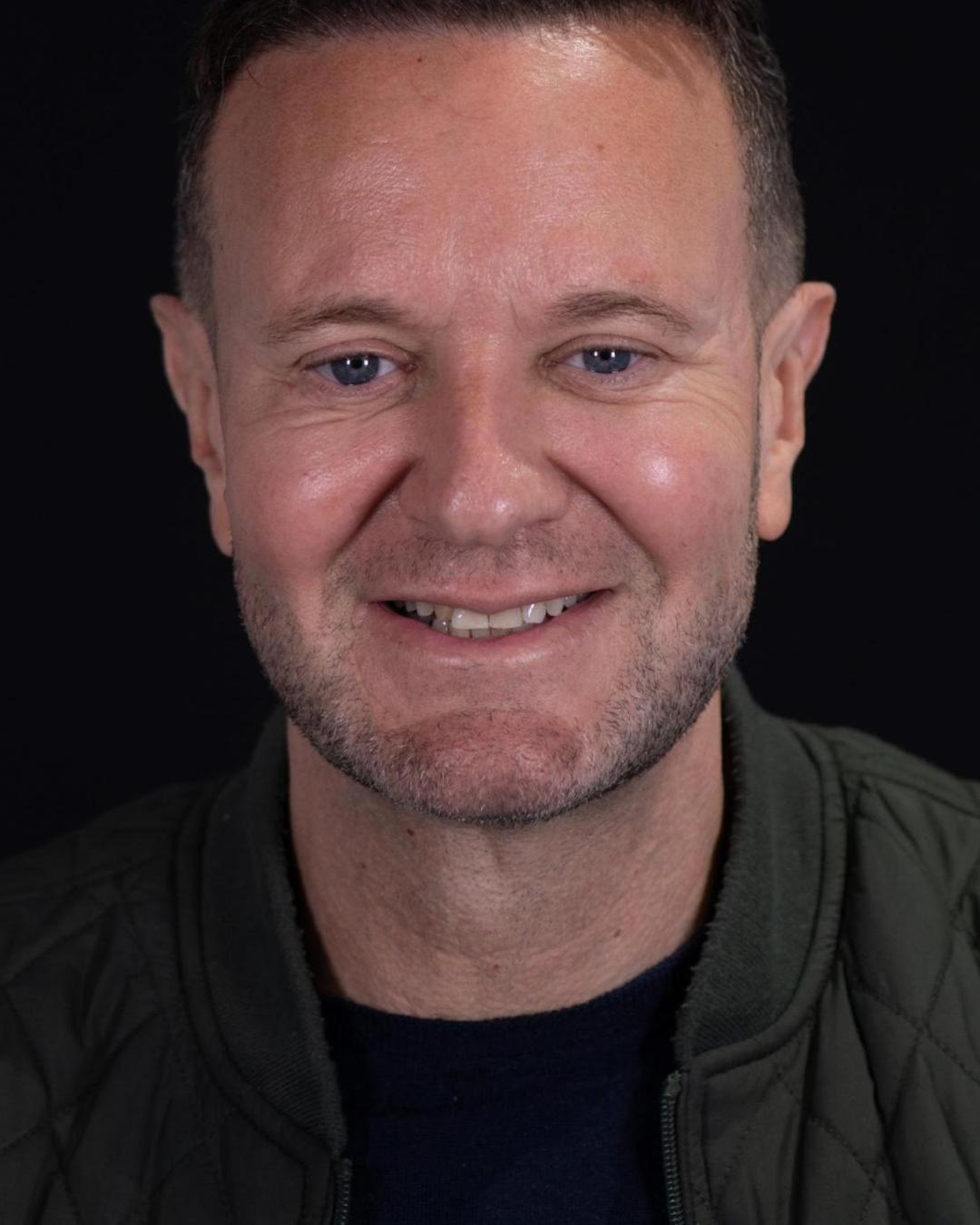 Before — Front View