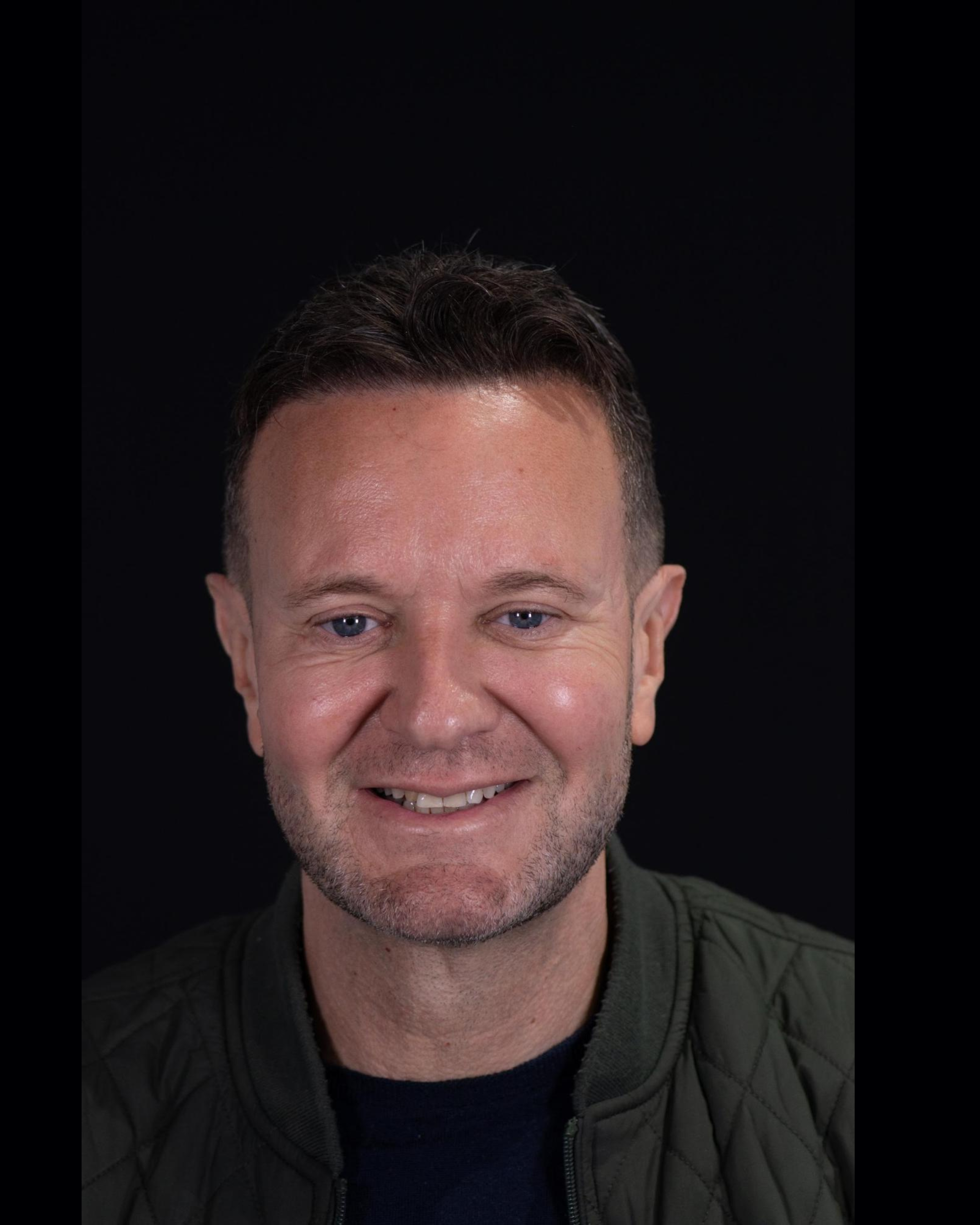 Before — Front View