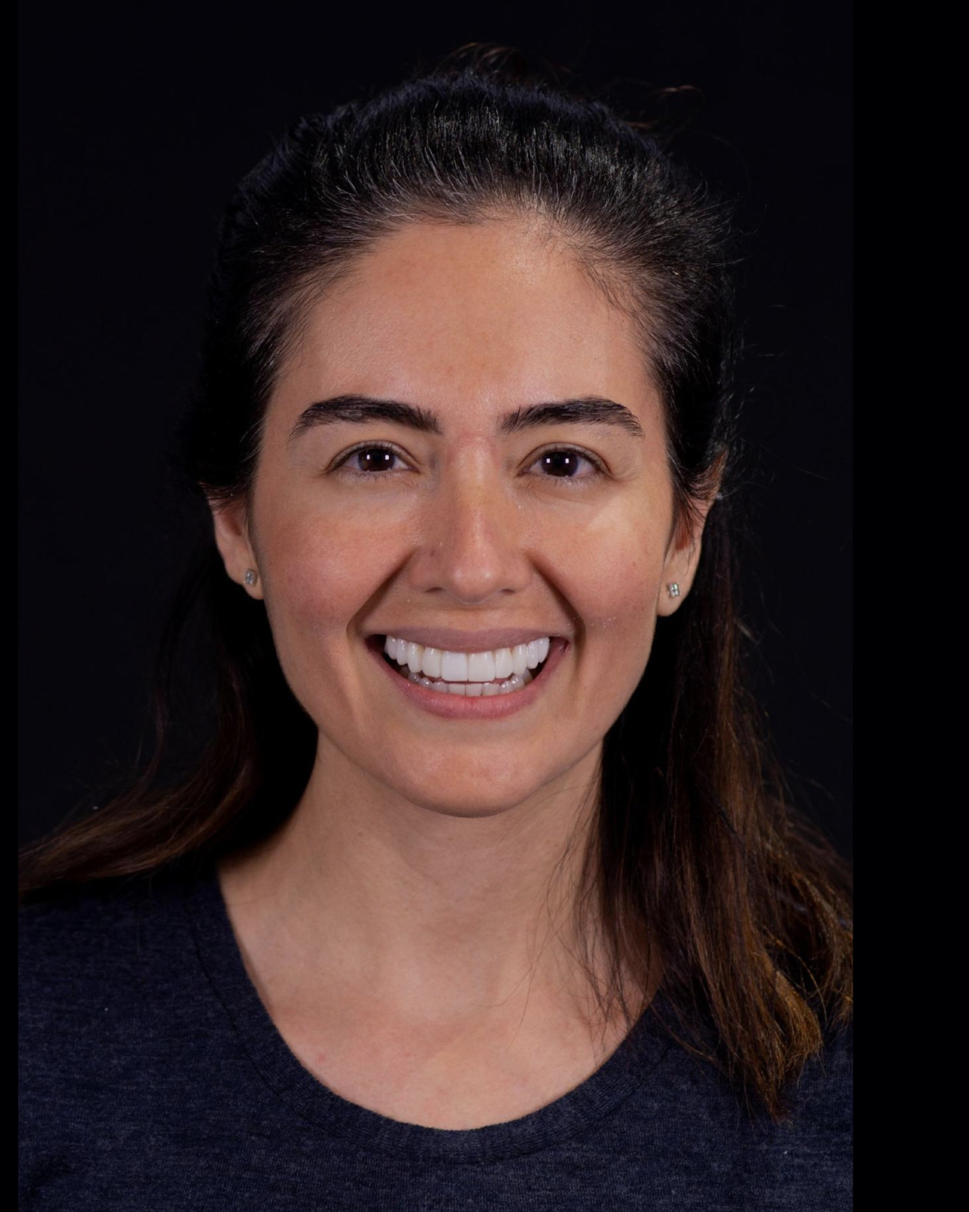 After — Front View