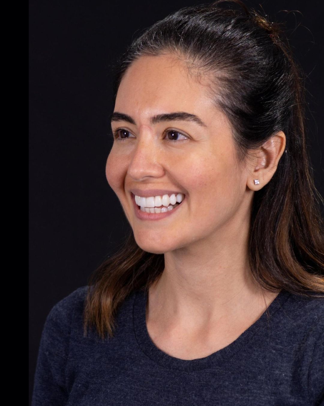 After — Right Profile