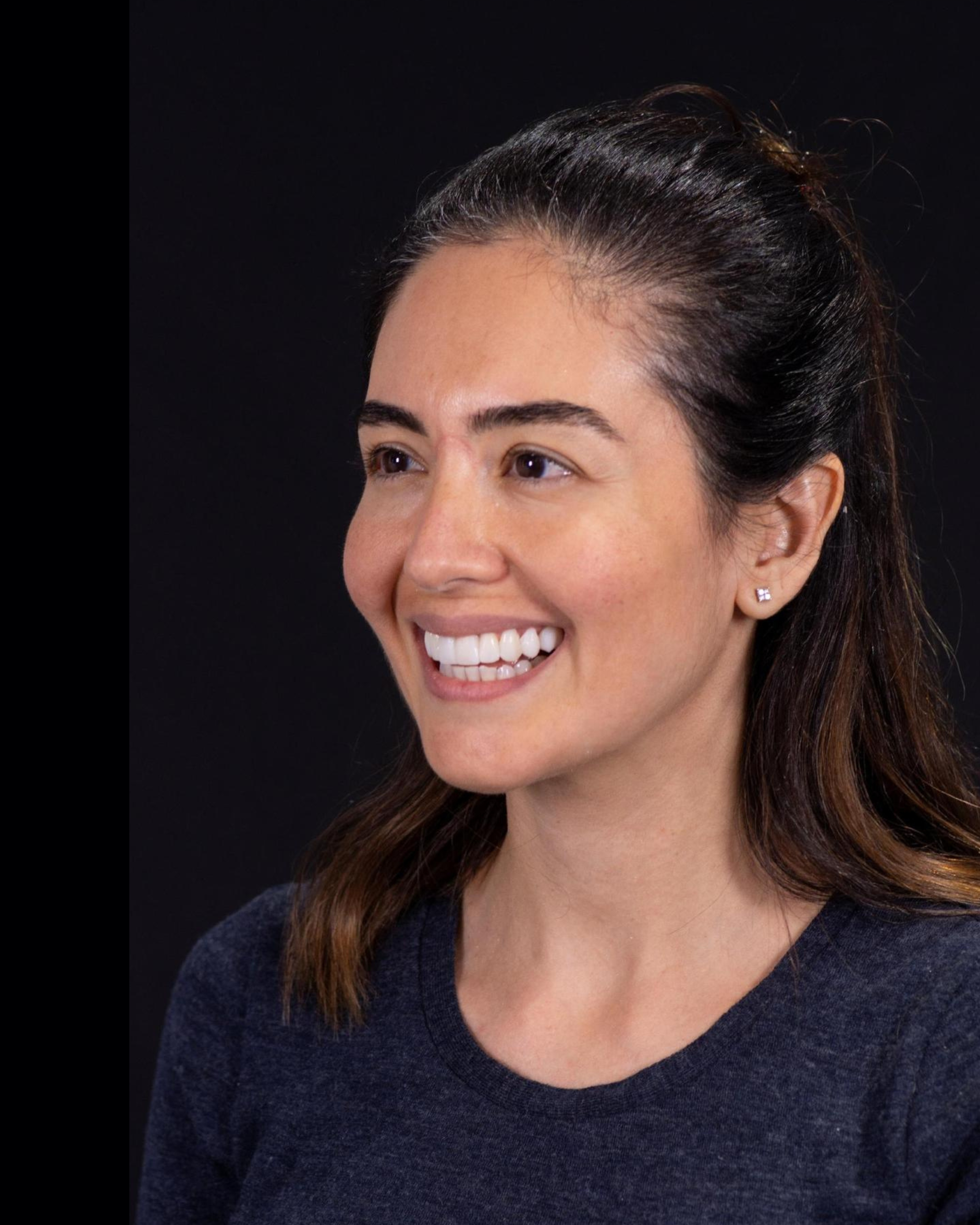 After — Right Profile