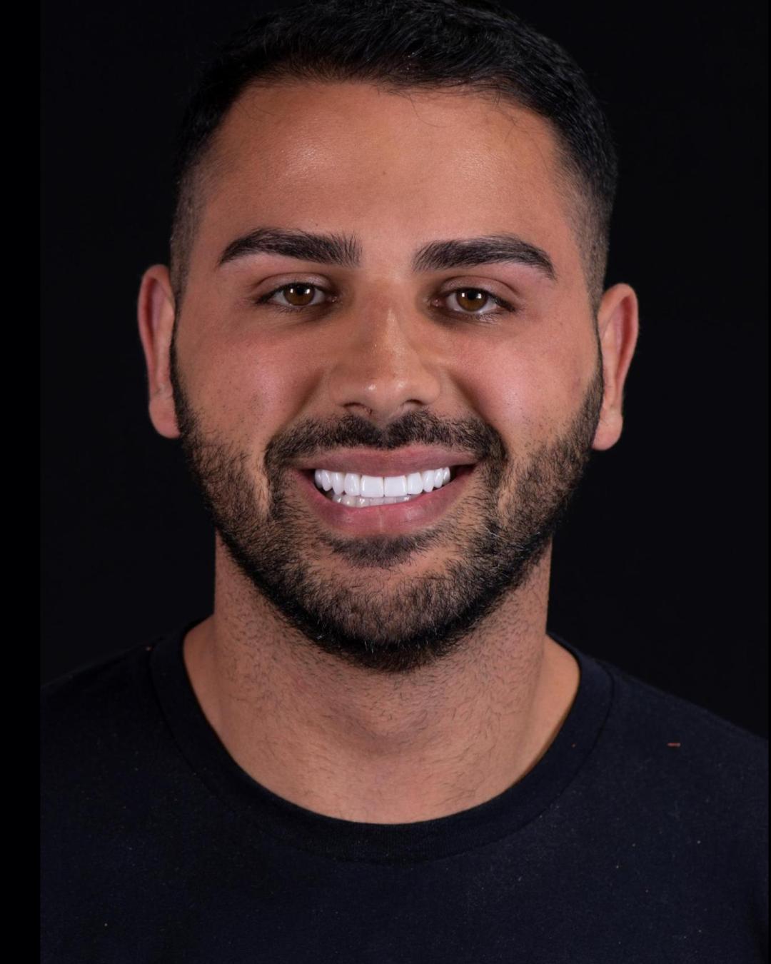 After — Front View