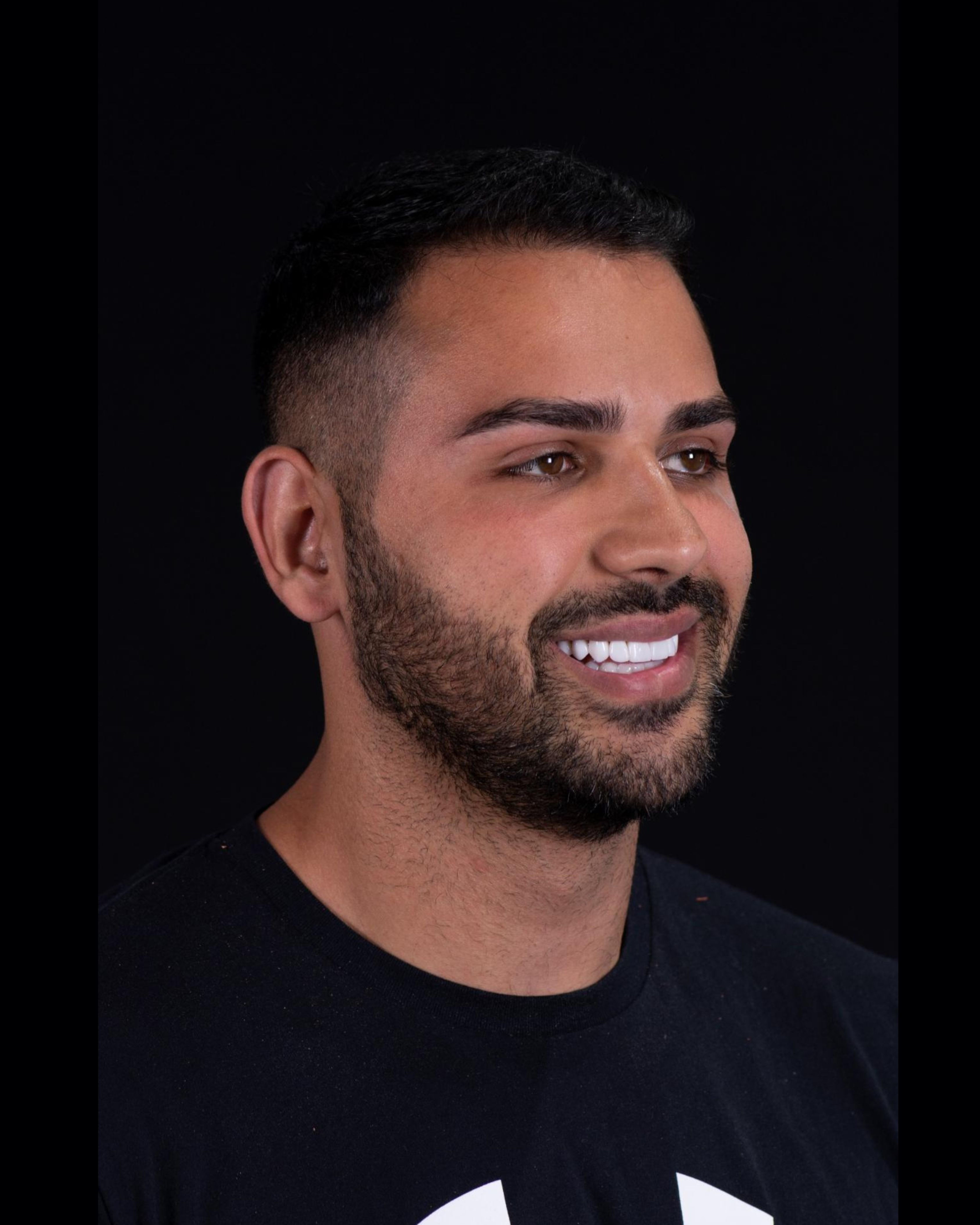 After — Left Profile