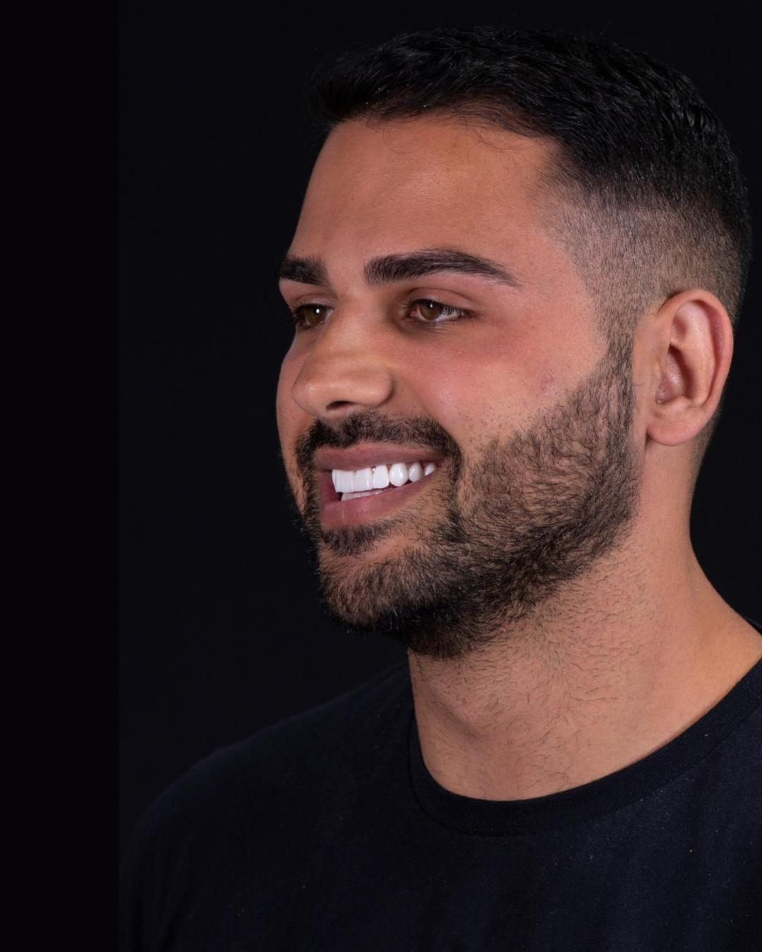 After — Right Profile