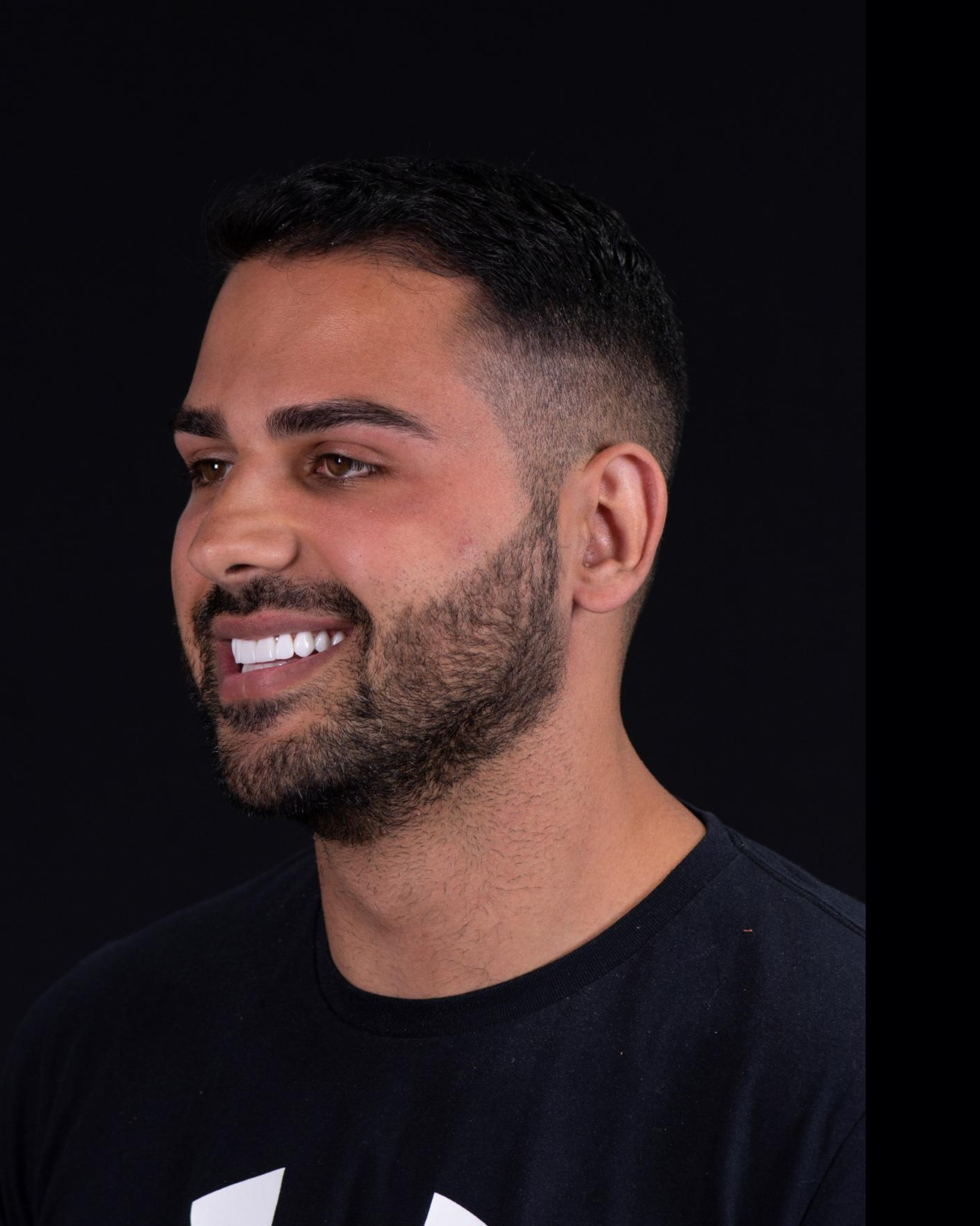 After — Right Profile