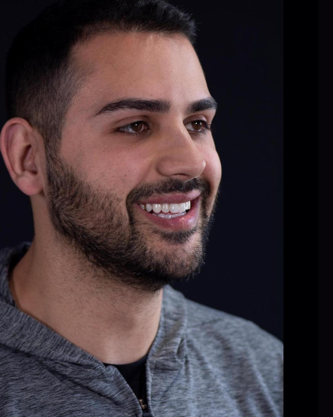 Before — Left Profile