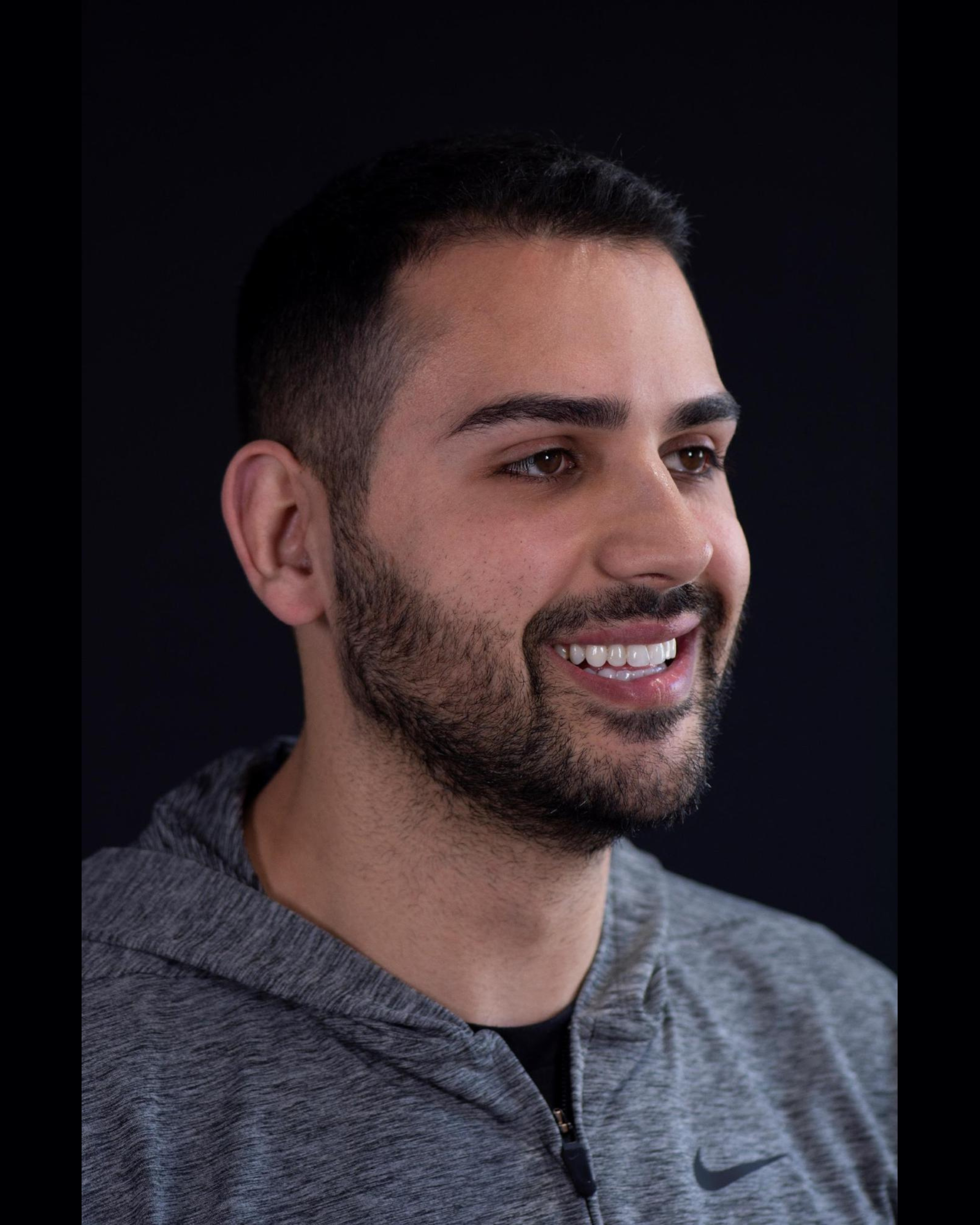 Before — Left Profile