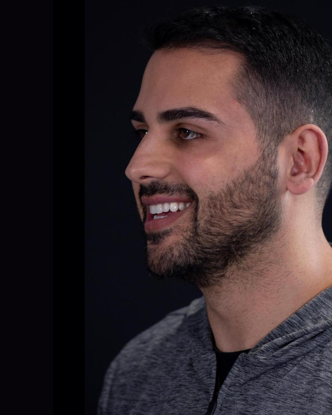 Before — Right Profile