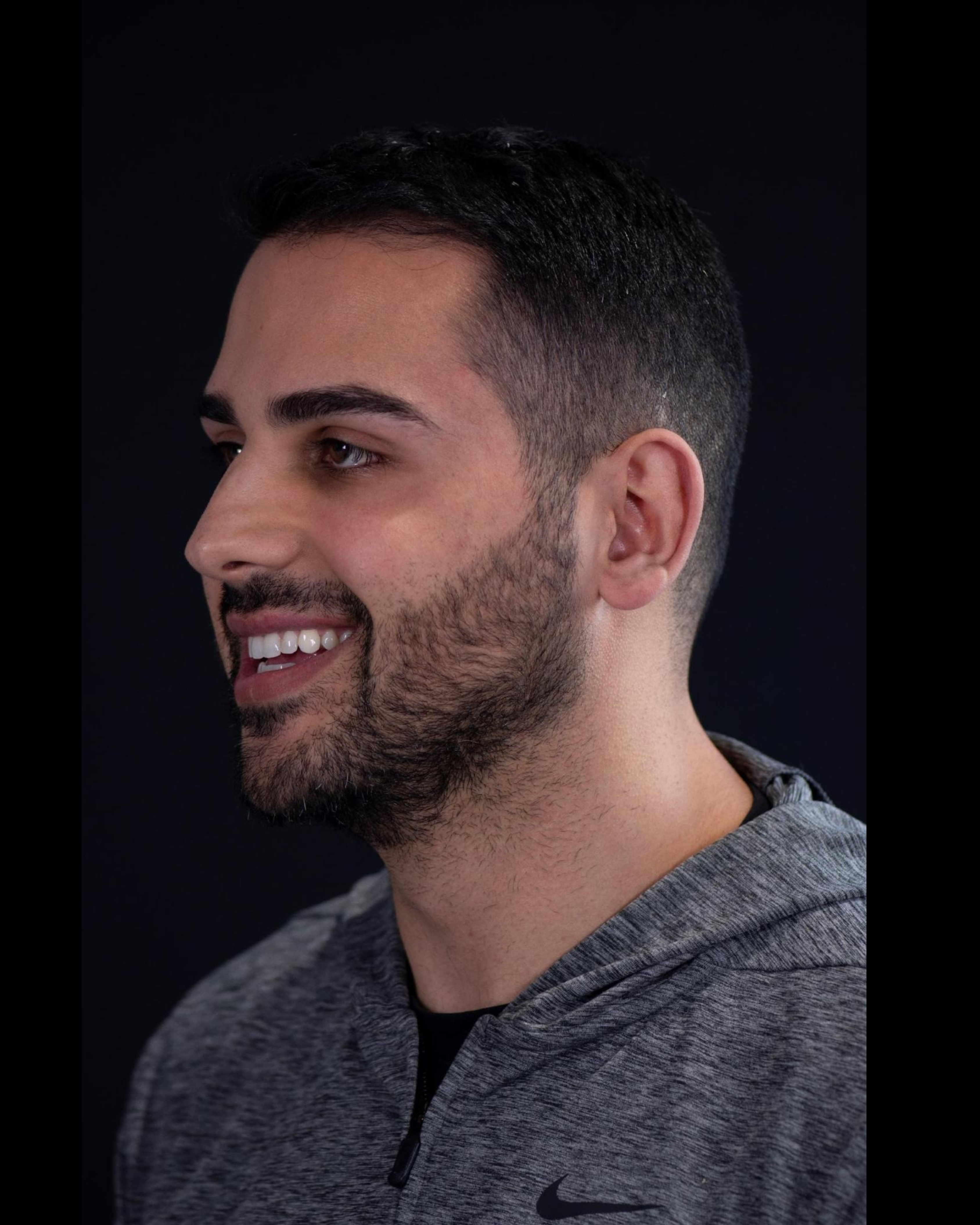 Before — Right Profile